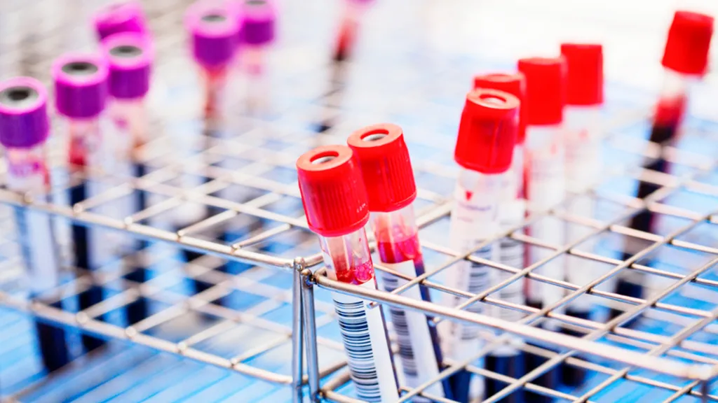 Injectable HIV prevention drug set for 'aggressive' rollout in Africa