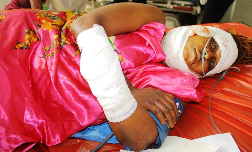 Jilted lover cuts off woman's palm