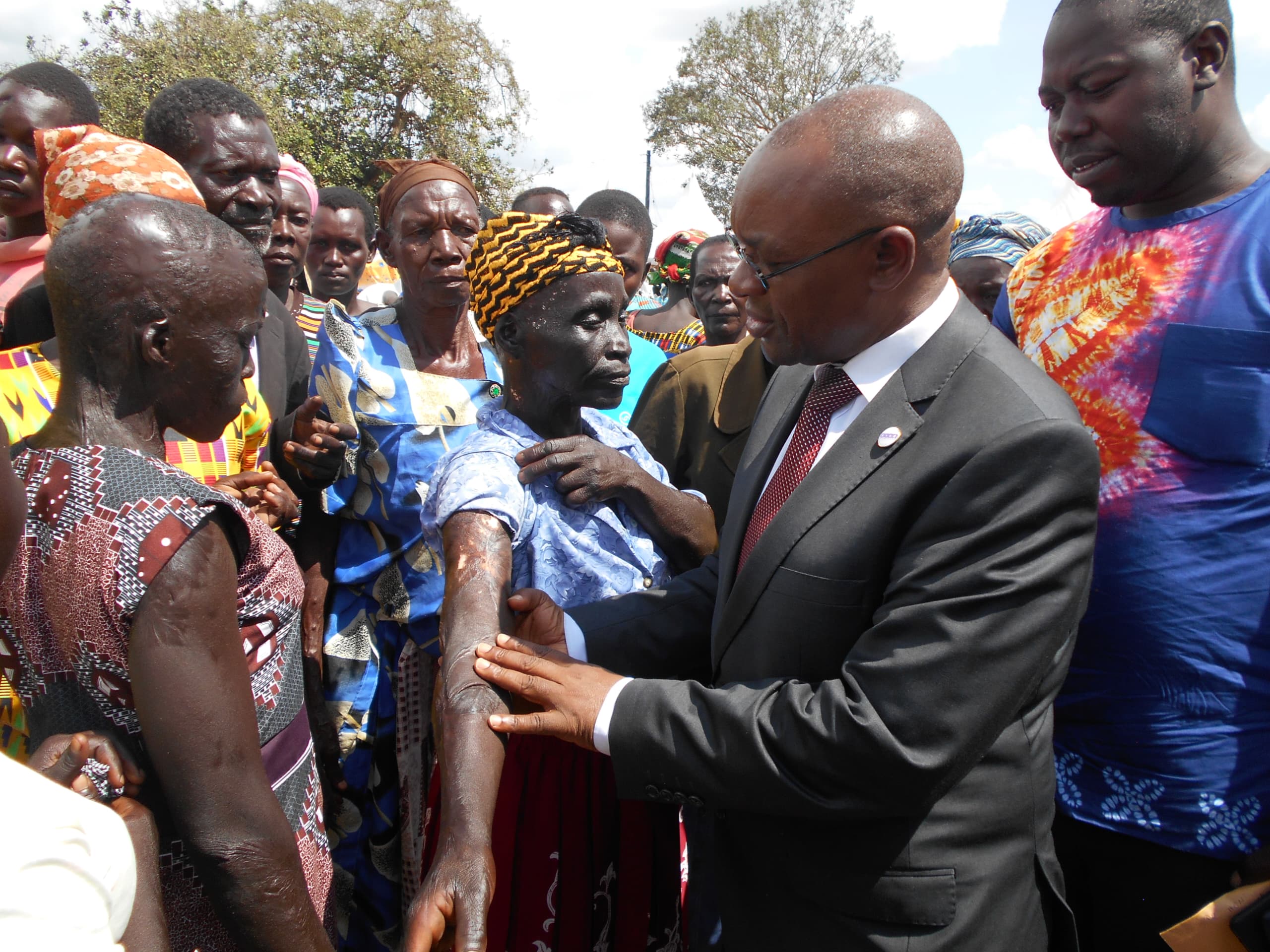 Hundreds turn up for LRA war victim’s surgical camp