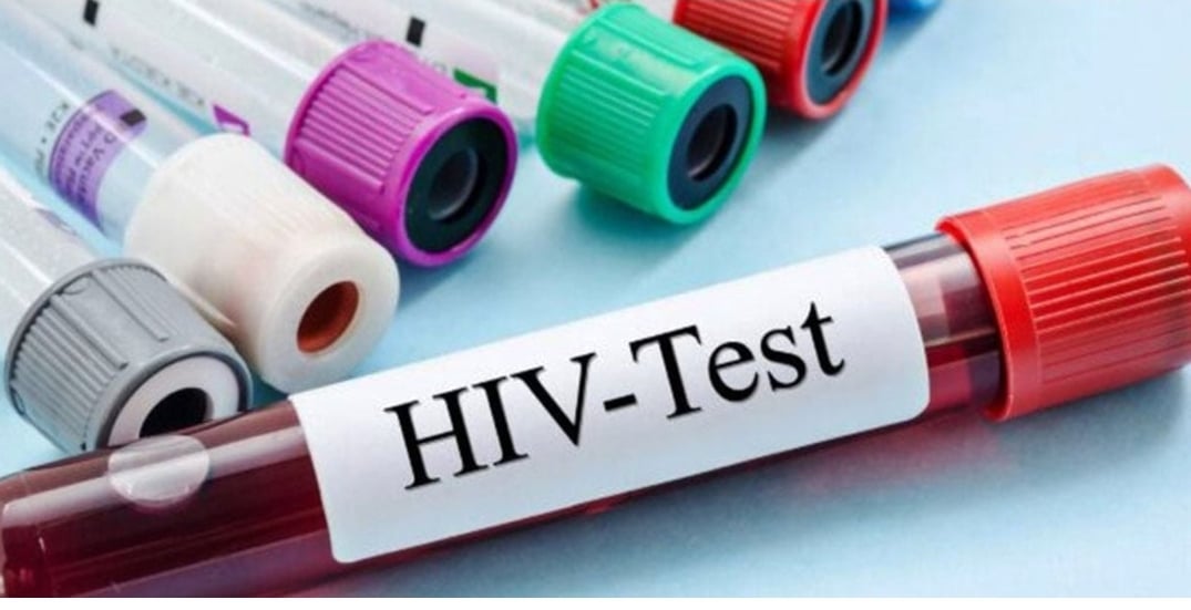 Government should consider regulatory impact assessment of HIV/AIDS control Act