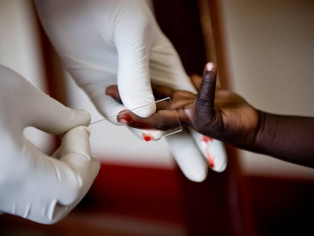 Govt Says UN's HIV Support 'Not Life-Saving' After US Ends Funding for Aids Program
