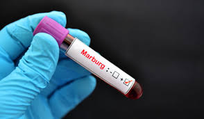 Rwandan Health Authorities Battle Marburg Virus Outbreak