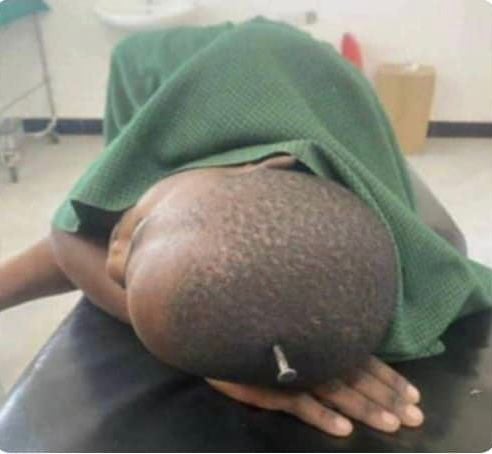 Bushenyi step-mother denies brutal assault