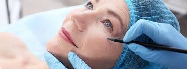 Rise in plastic surgery reflects evolving beauty standards