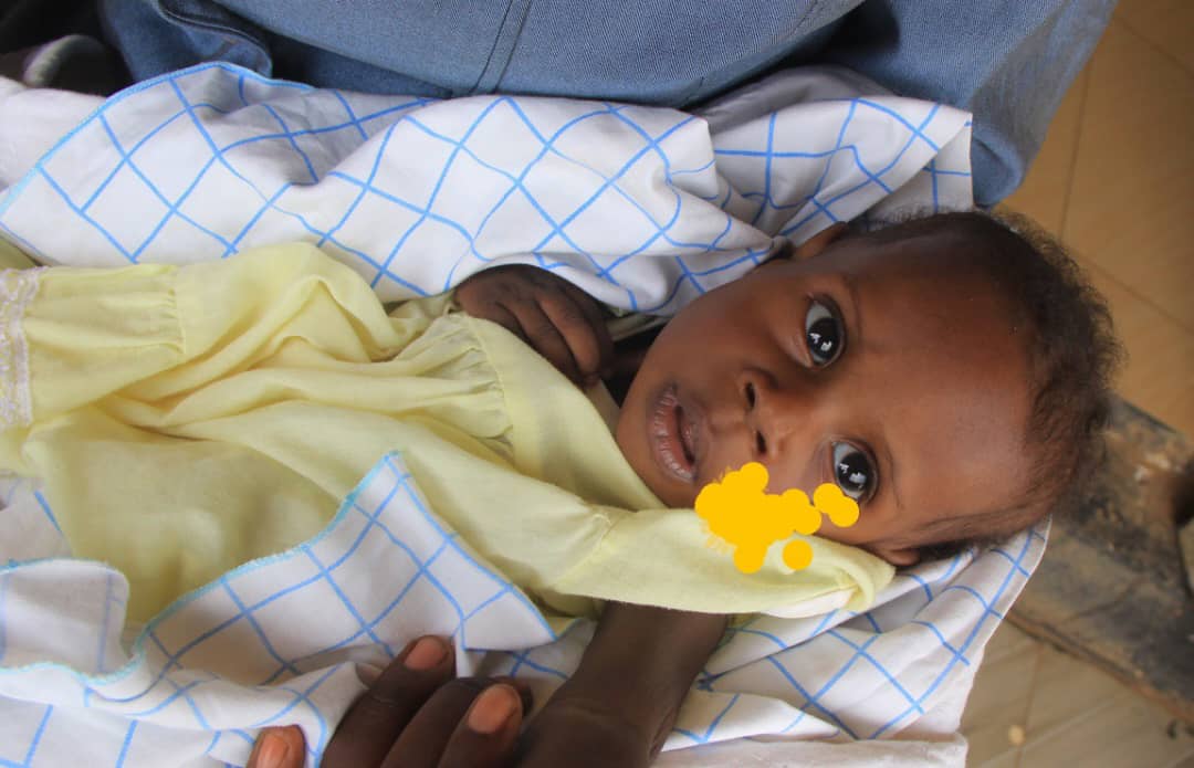Kikuube couple  seeks shs47m for child's heart surgery in India