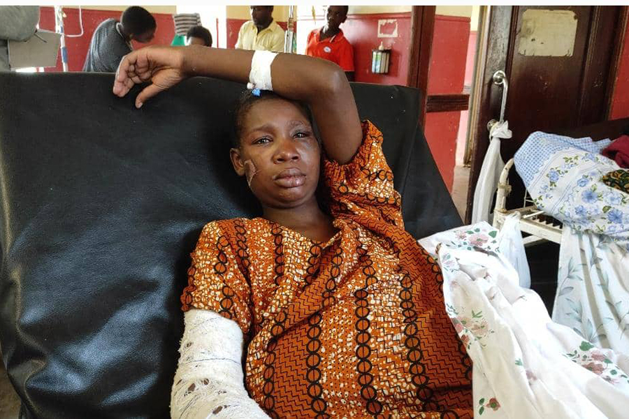 Woman, 23, Severely Mutilated in Brutal Domestic Attack in Isingiro