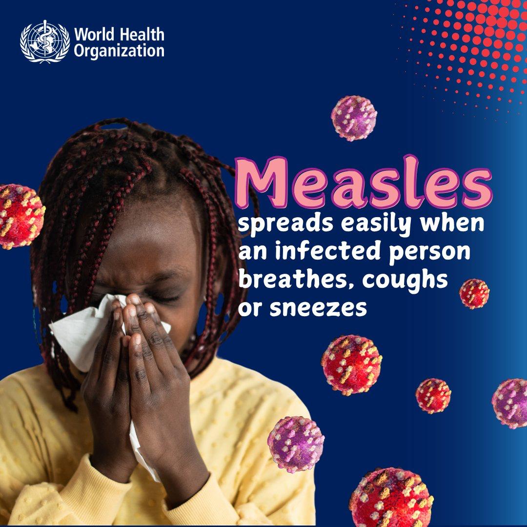 WHO Warns of Measles Surge in Sub-Saharan Africa, Urges Vaccination