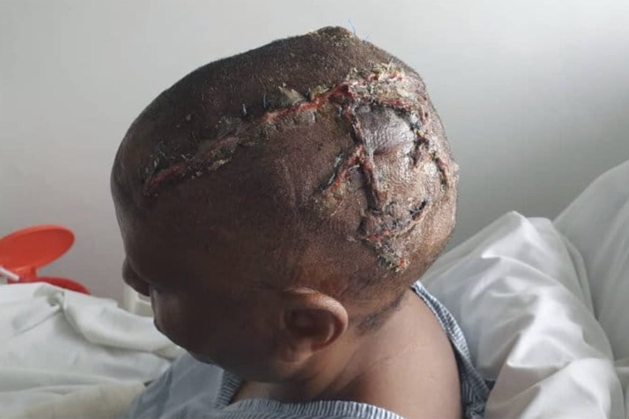 Molly Katanga’s Injuries Described as ‘Catastrophic’ in Court as Nurse Recounts Bloody Morning Scene