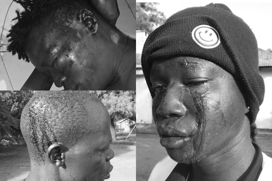 Moroto Supporters Spill Blood at Campaign Rally