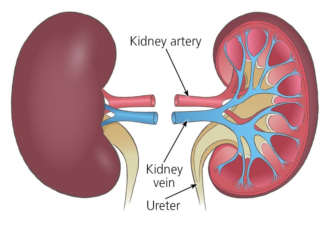 How Lifestyle Choices Led to my Kidney Failure
