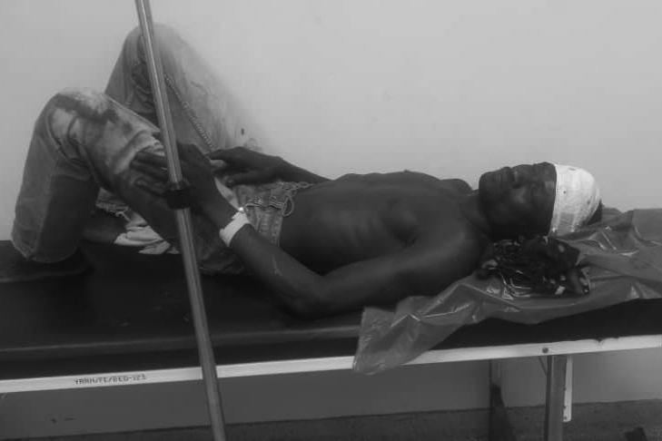 One Killed, Several Injured in NRM Primaries Violence in Yumbe