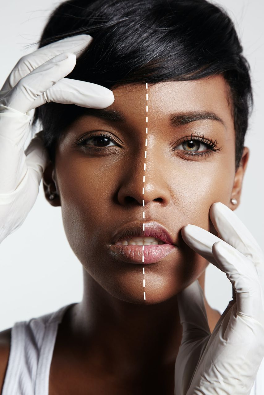 How Skin Lightening Creams Work, and Why Caution Matters