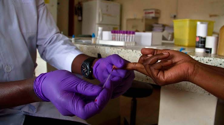 Men Face Higher HIV Impact Due to Poor ARV Uptake-Uganda AIDS Commission