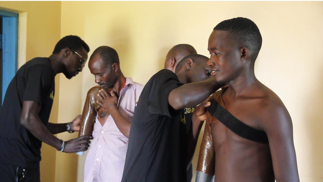 Ibanda Amputees Receive Free Prosthetic Arms from Elpis Rehabilitation Centre
