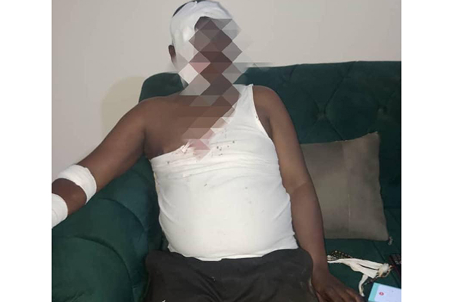 Nakaseke District Boss Survives Brutal Night Attack