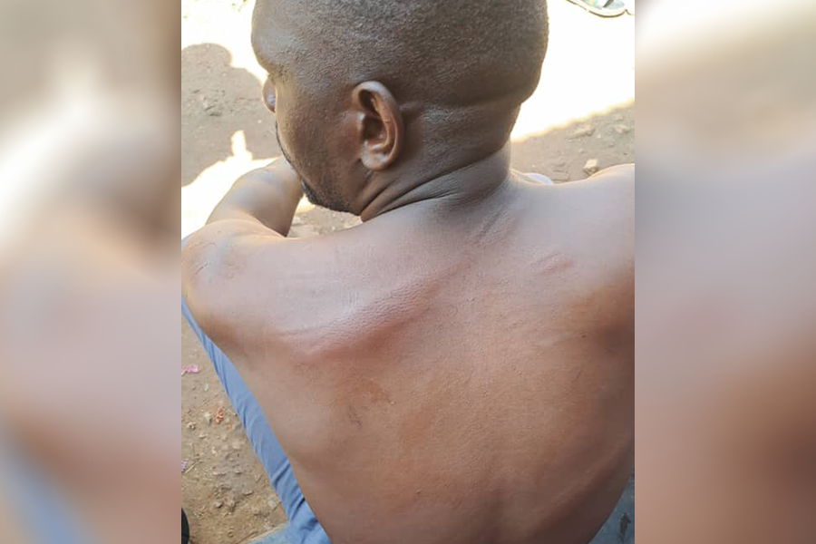 Violence and Injuries Mar Nansana Mayoral Elections