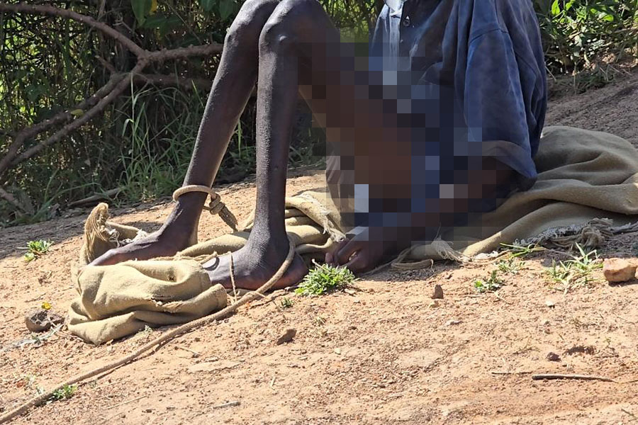 Father Seeks Help for Teen Girl Tied to Tree Daily Over Mental Health