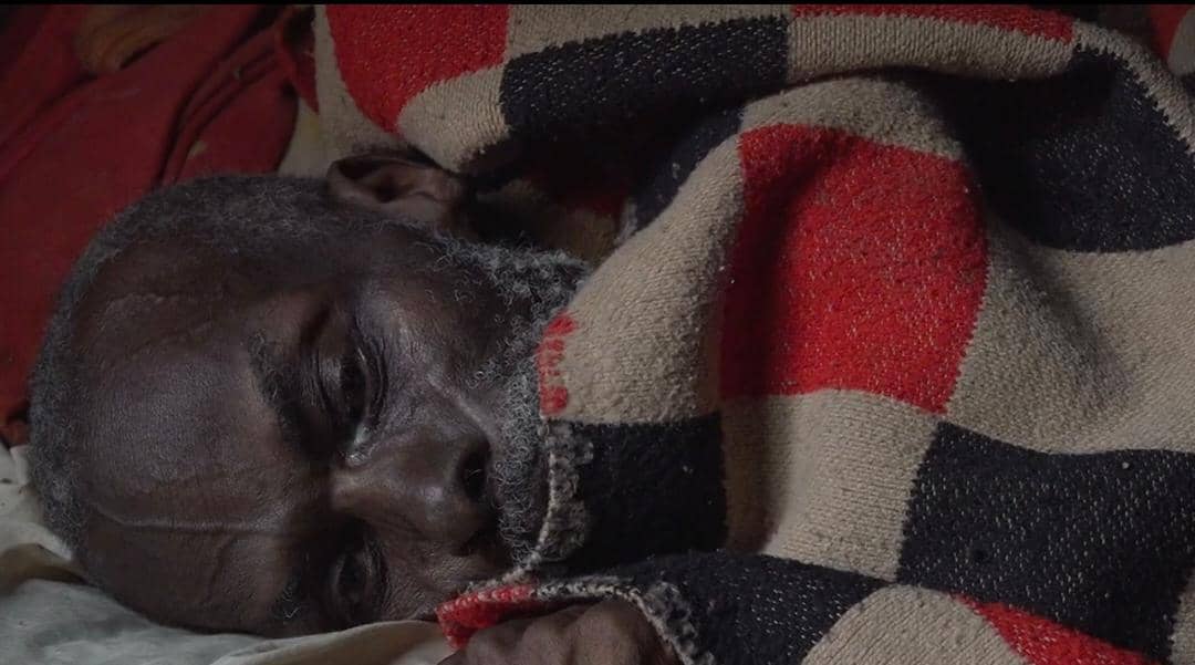 74-Year-Old Lonely Man Found Alive with Severely Decayed Lower Body