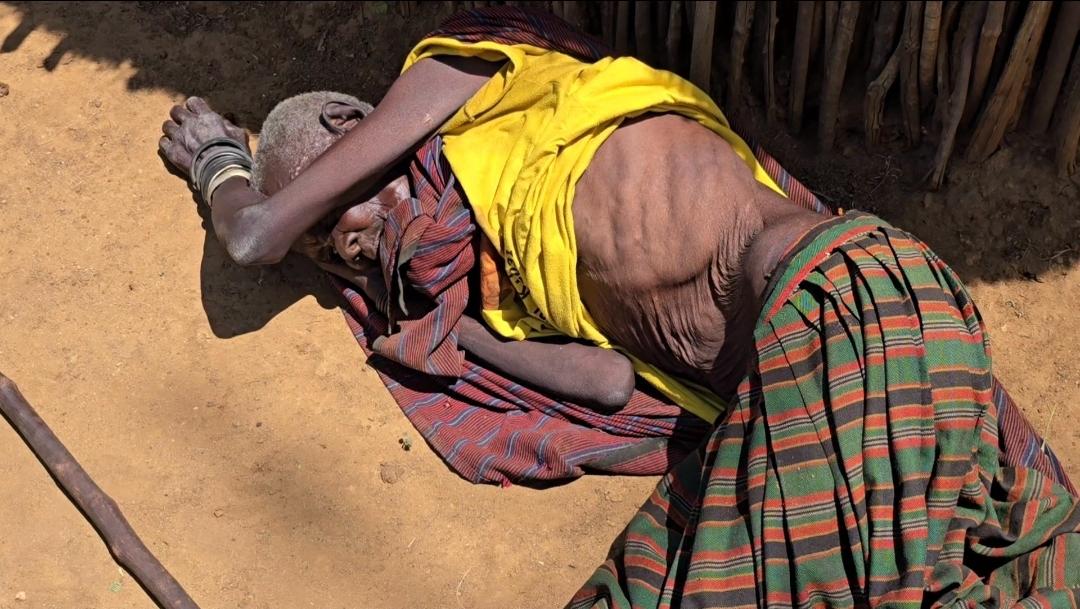 PHOTOS: Karamoja Hunger Death Toll Rises to 19