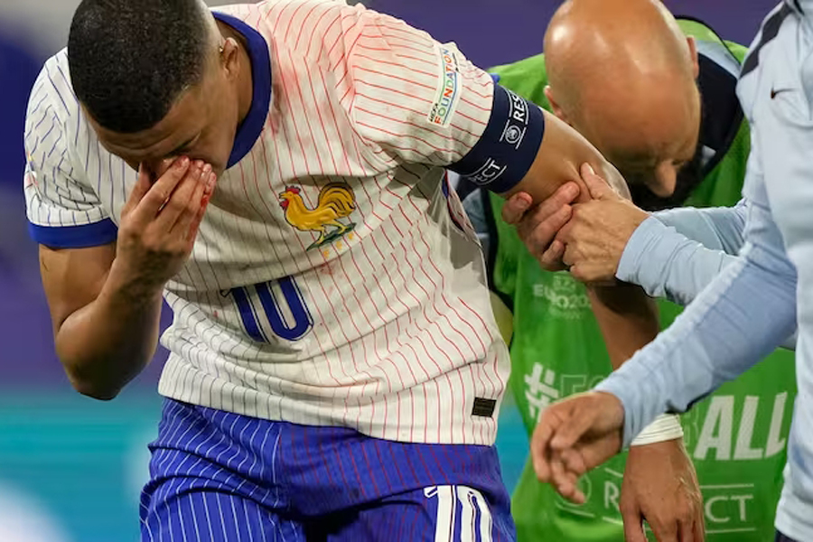 Mbappe suffers broken nose during France win