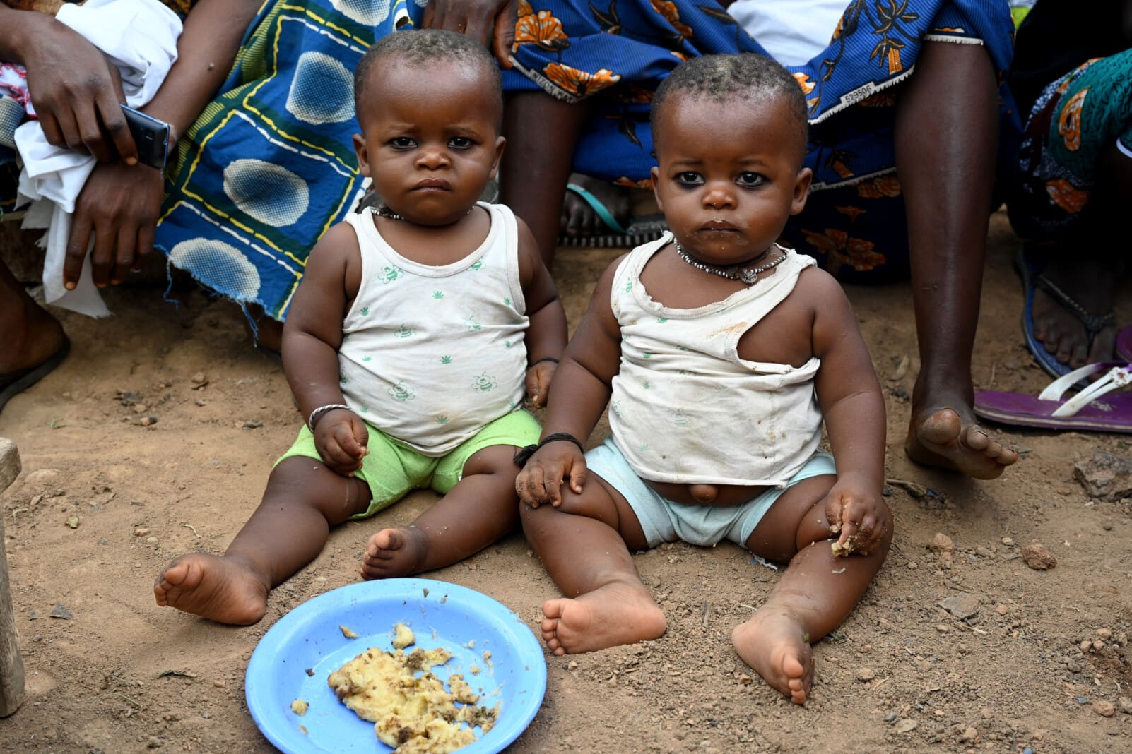 High cases of malnutrition worry Kiryandongo