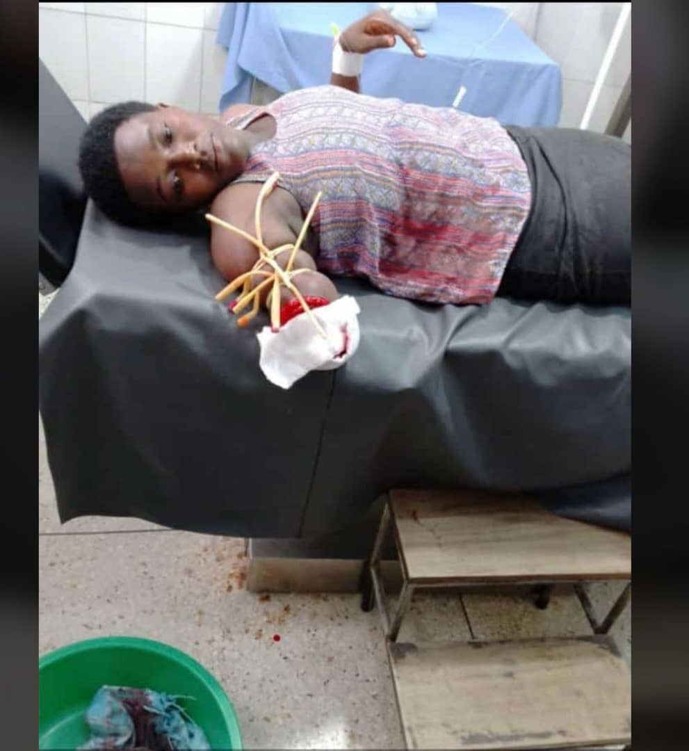 Jilted lover chops off woman's hand in Ibanda