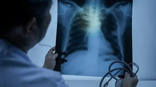 WHO Announces First Prequalification of Tuberculosis Diagnostic Test