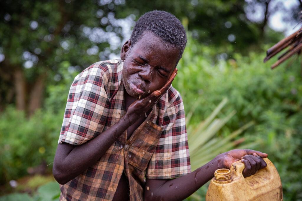 The forgotten disease: Nodding syndrome