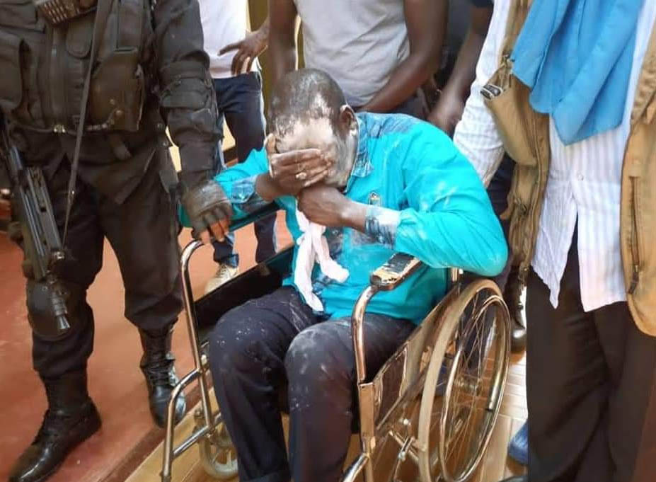 Baby Powder doesn't work: Amuriat pepper sprayed as he attempts to enter  Tororo for campaigns, hospitalized - Nile Post