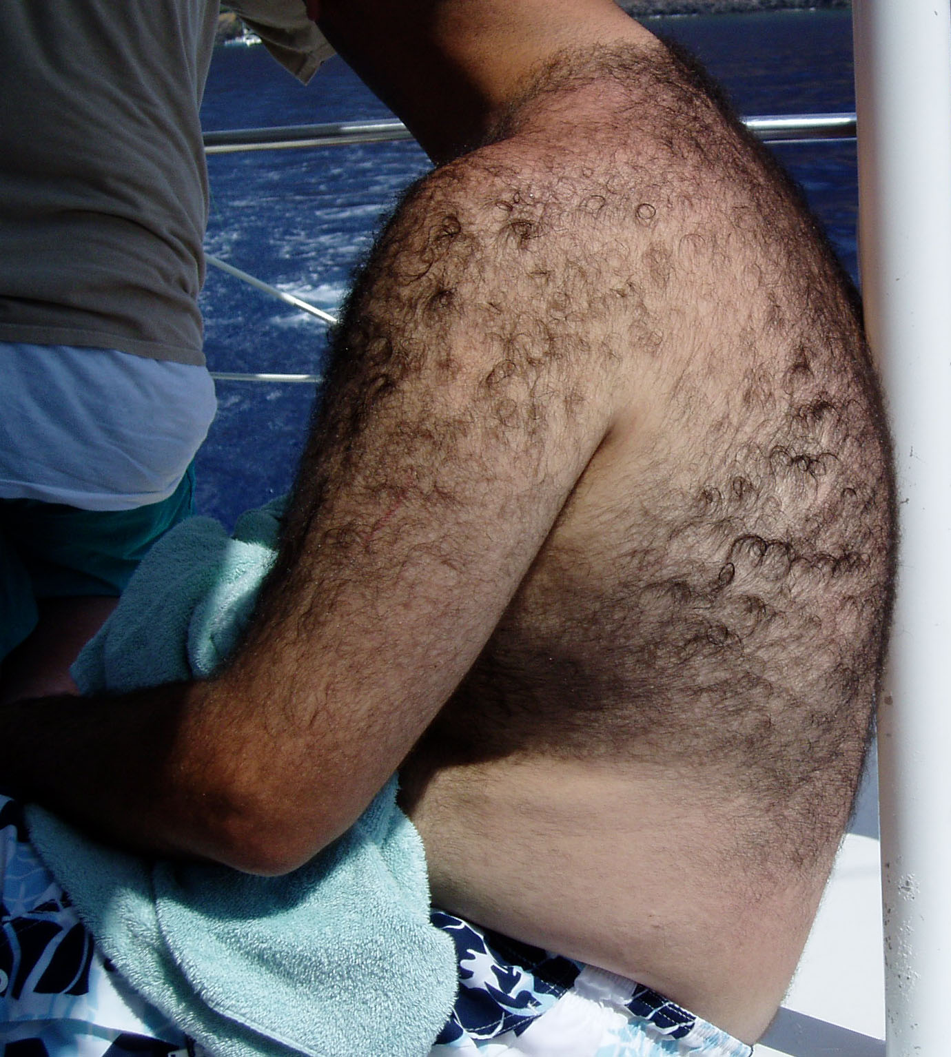 How do you manage excessive body hair?