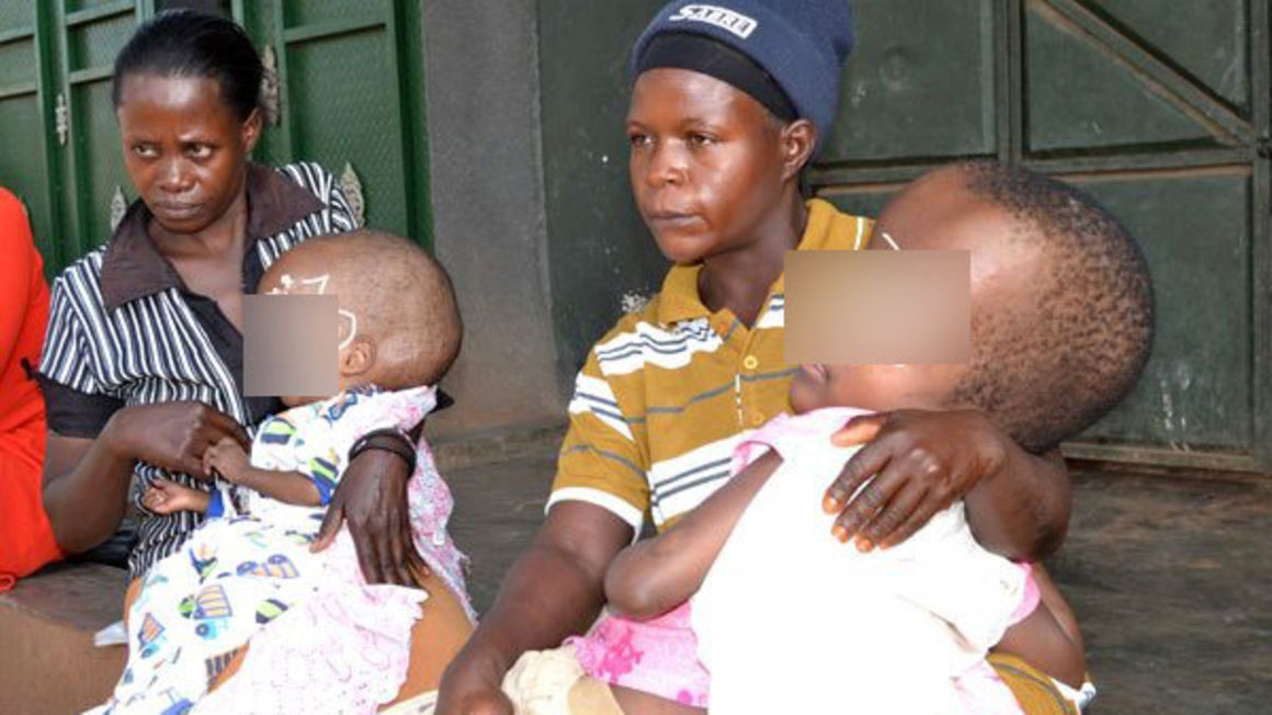 Lockdown puts children with spina bifida , hydrocephalus in worse dilemma