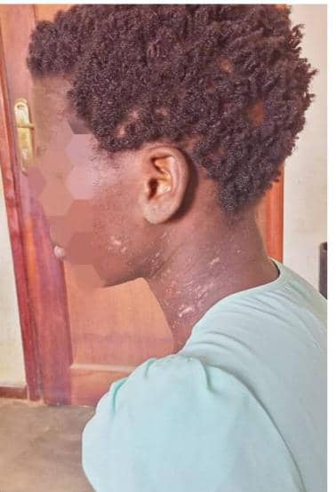 Police arrests woman for burning housemaid with flat iron, hot water