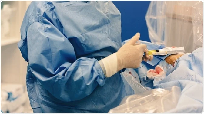 Fibroid embolization procedure now a possibility in Uganda