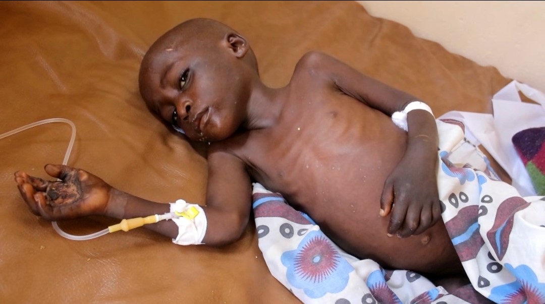 6-year old accuses parents of torture