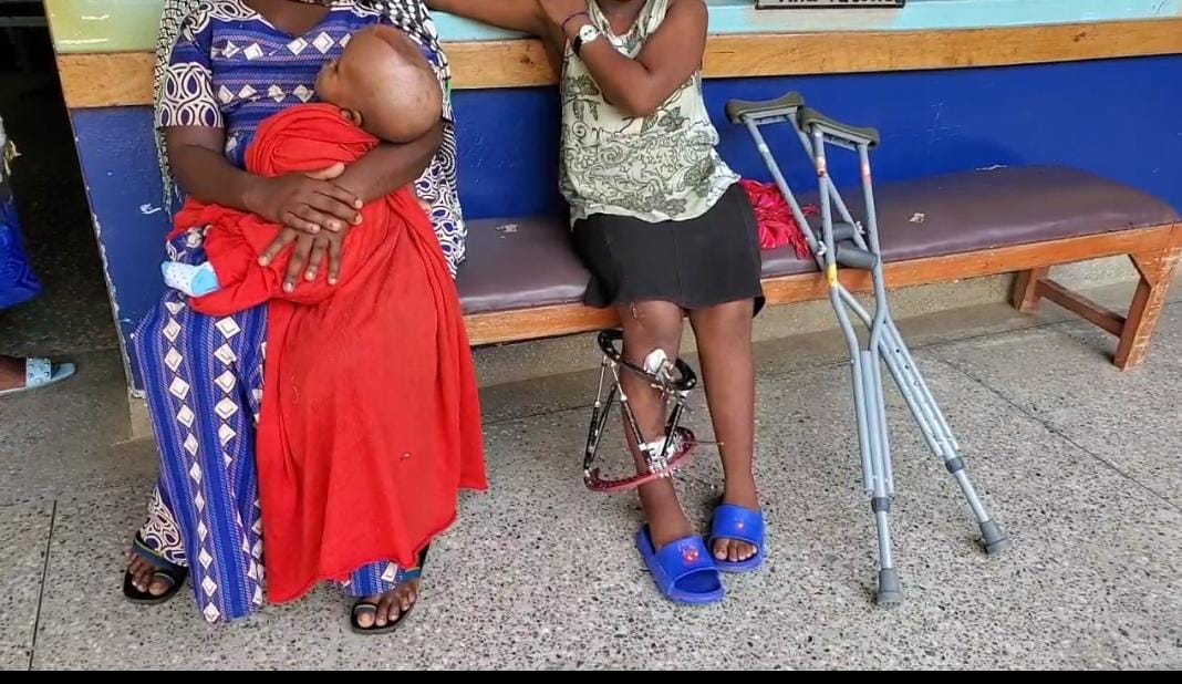 Western Uganda Grappling with surge in Children born and living with Disabilities