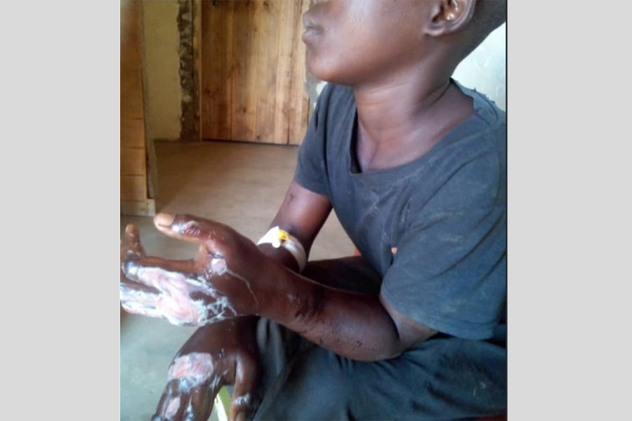 Child Abuse Cases Drop by 9% in Uganda, but Concerns Persist