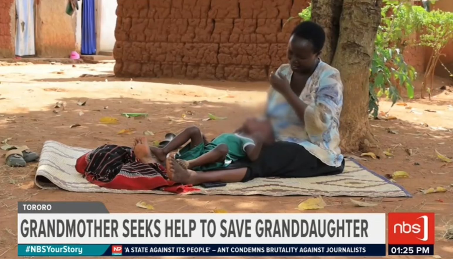 Featured image for Tororo grandmother appeals for help as granddaughter battles rare tongue condition