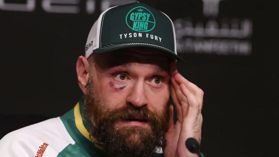 Fury will never fight again - Arum