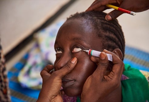 WHO Announces Burundi Has Eliminated Trachoma as a Public Health Problem