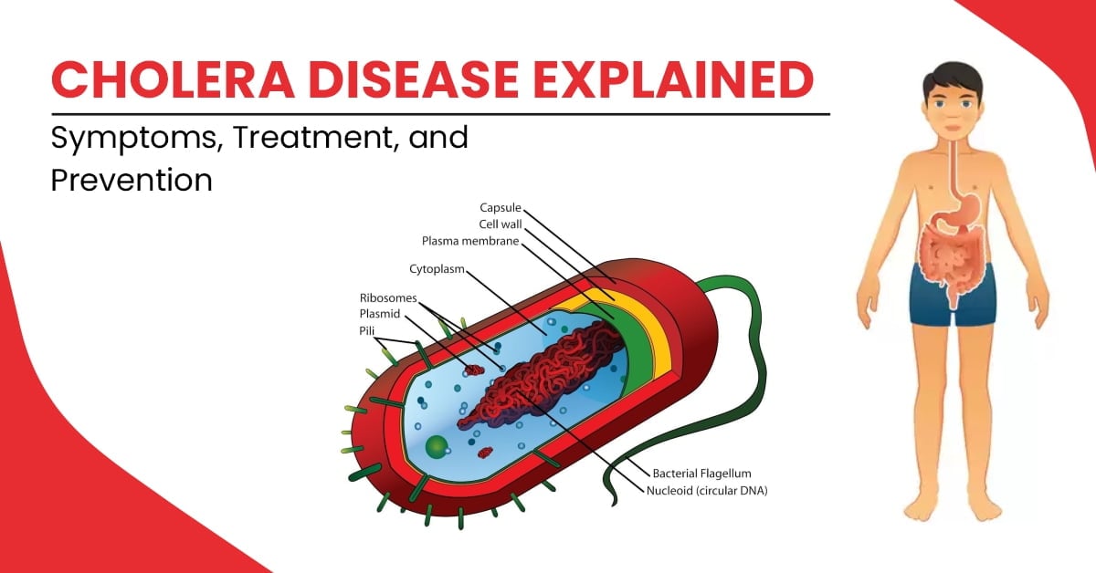 Cholera Cases Decline in Parts of Africa, But Kinshasa Remains a Hotspot — Africa CDC